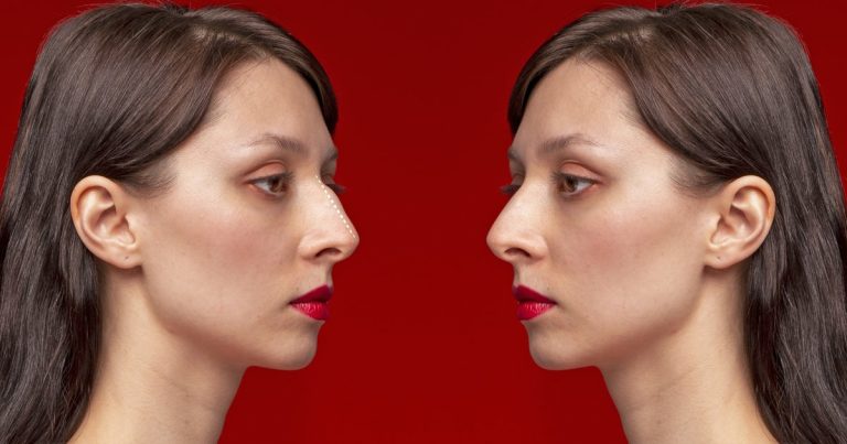 Nose Shape & Personality: What Face Reading Sees in Your Nose